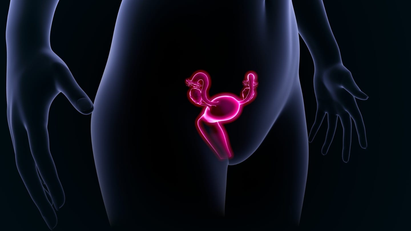 Could you have Polycystic Ovary Syndrome?